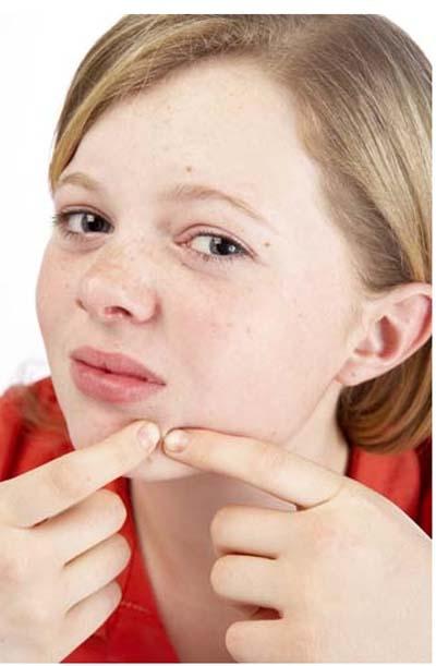 Cómo deshacerse de las espinillas del acné