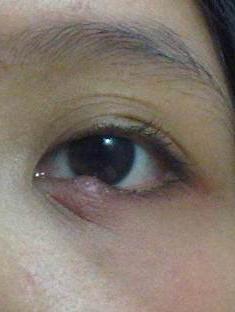 Pomada de ojo de tetraciclina. Instrucciones de uso Descripción, indicaciones